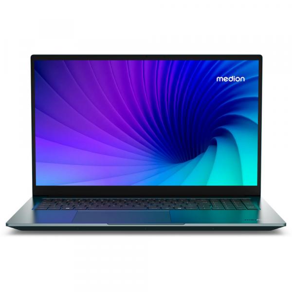 Medion S20 MD62640 17,3 i5 Ultra-155H 16GB 1TB Windows 11 Home